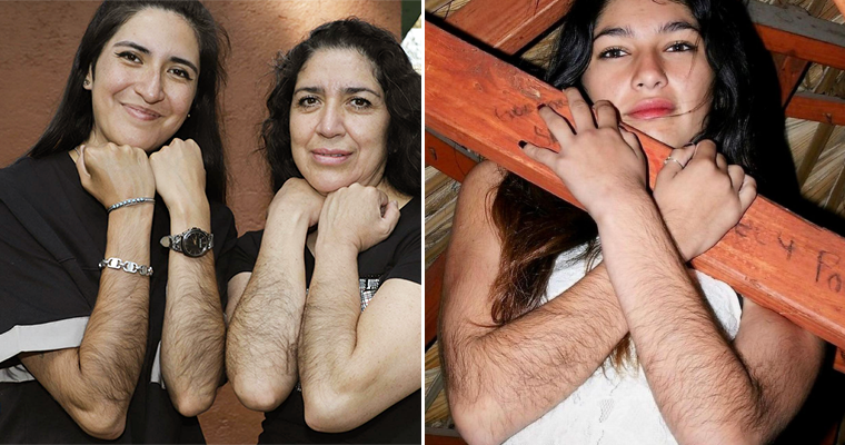 Girls With Hairy Arms Websites